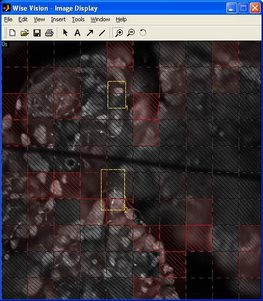 Program for analysis of microscopic images